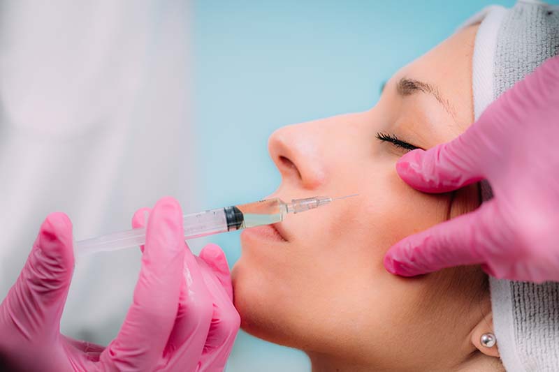 McAllen Dermal Fillers Lip Fillers