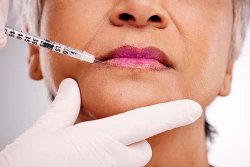 McAllen Dermal Fillers Lip Fillers and more